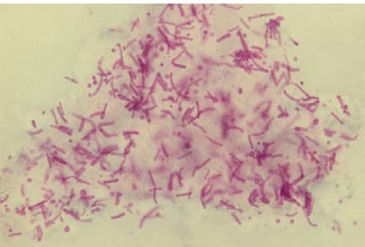<p>b. Malassezia furfur</p>