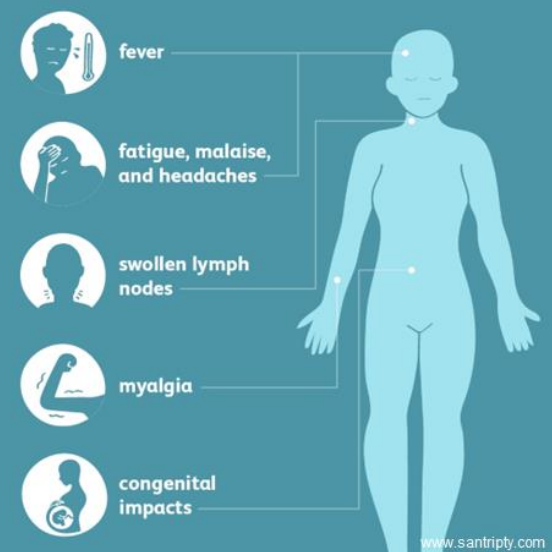 <p>Majority of patients (85-90%) are asymptomatic</p><ul><li><p>Febrile illness with malaise</p></li><li><p>Fatigue</p></li><li><p>Headache</p></li><li><p>Muscle pain</p></li><li><p>Cervical and axillary lymphadenopathy</p></li></ul><p></p>