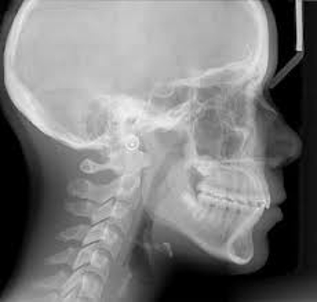 <p>mainly used in ortho but it helps to see development</p>