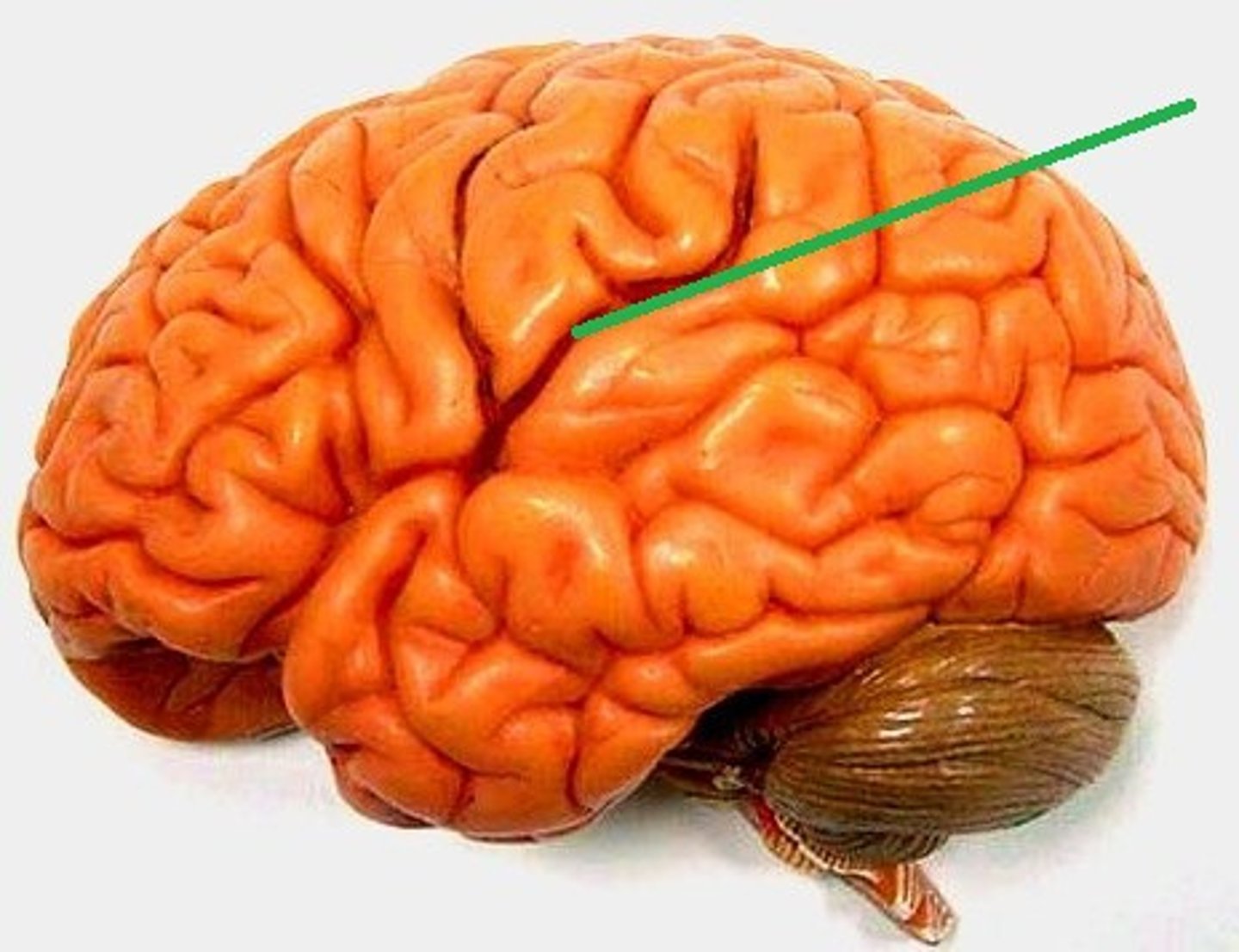 <p>sylvian/lateral fissure</p>