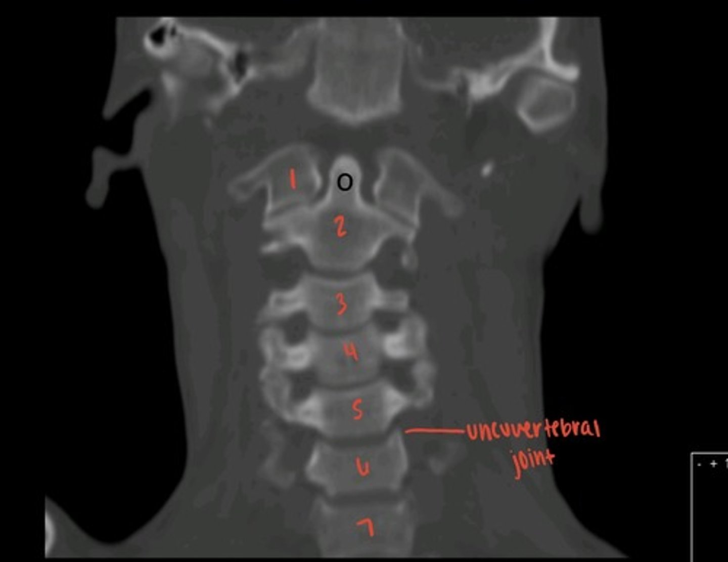 <p>what is this image?</p>