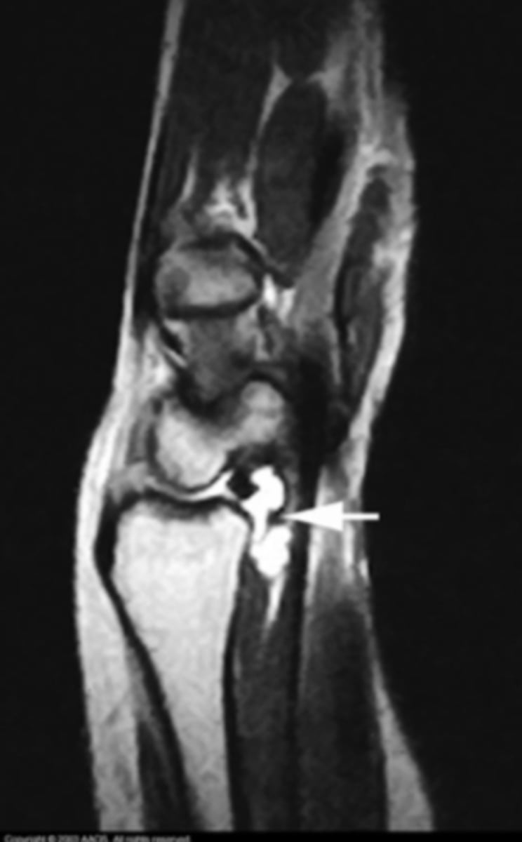 <p>What is the issue?</p>