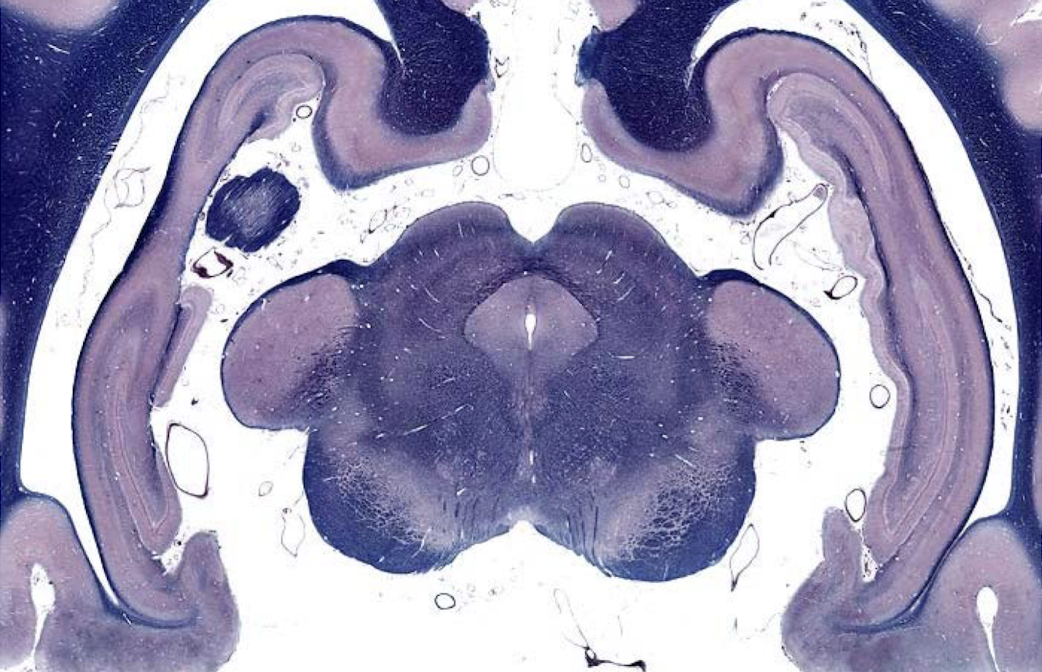 <p>what section of the brain is this?</p>