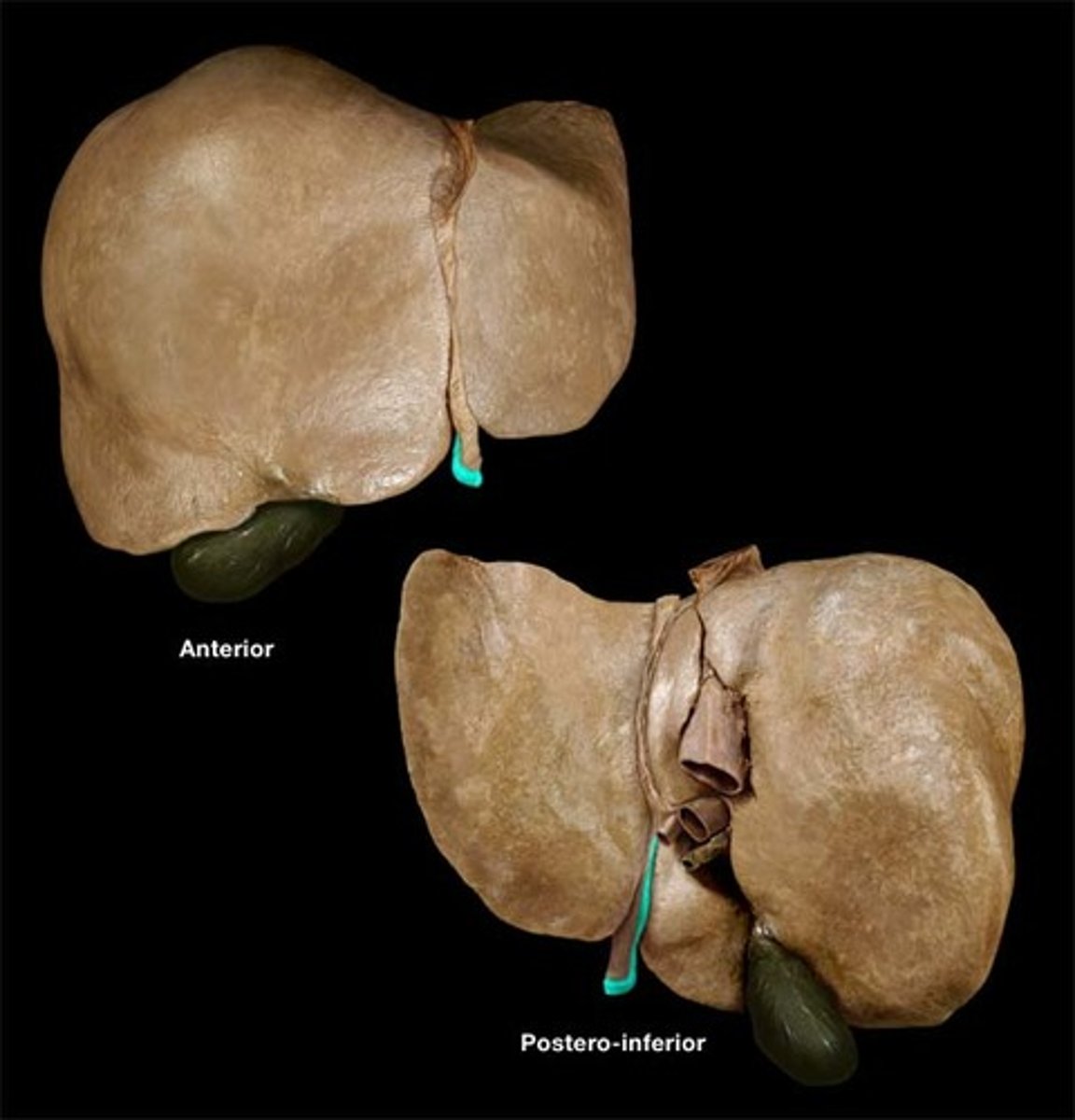 <p>remnant of umbilical vein</p>