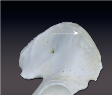 <p>narrow, ridgelike projection</p>