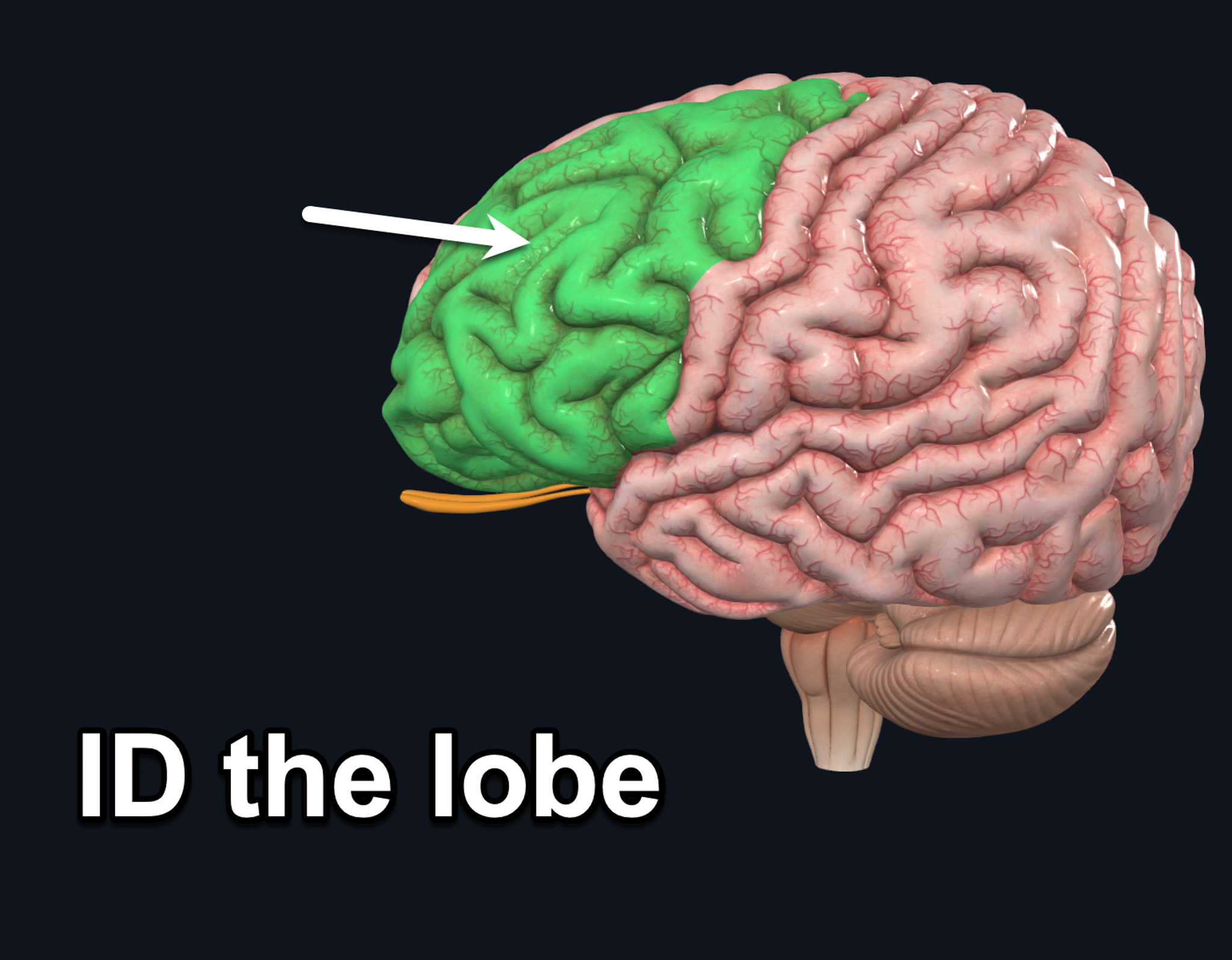 term image