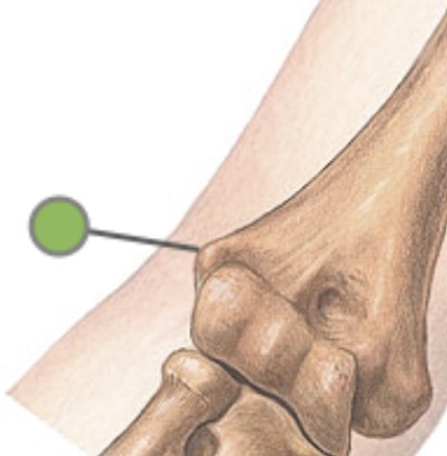 <p>Which bone landmark of the humerus is a bony knob above capitulum on the lateral side?</p>