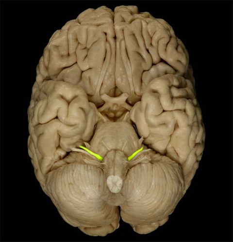 <p>Cranial nerve VII *Sensory - sense of taste for the front of the tongue. *Somatic Movement of the facial expression skeletal muscles *parasympathetic stimulation of salivary and lacrimal glands.</p>