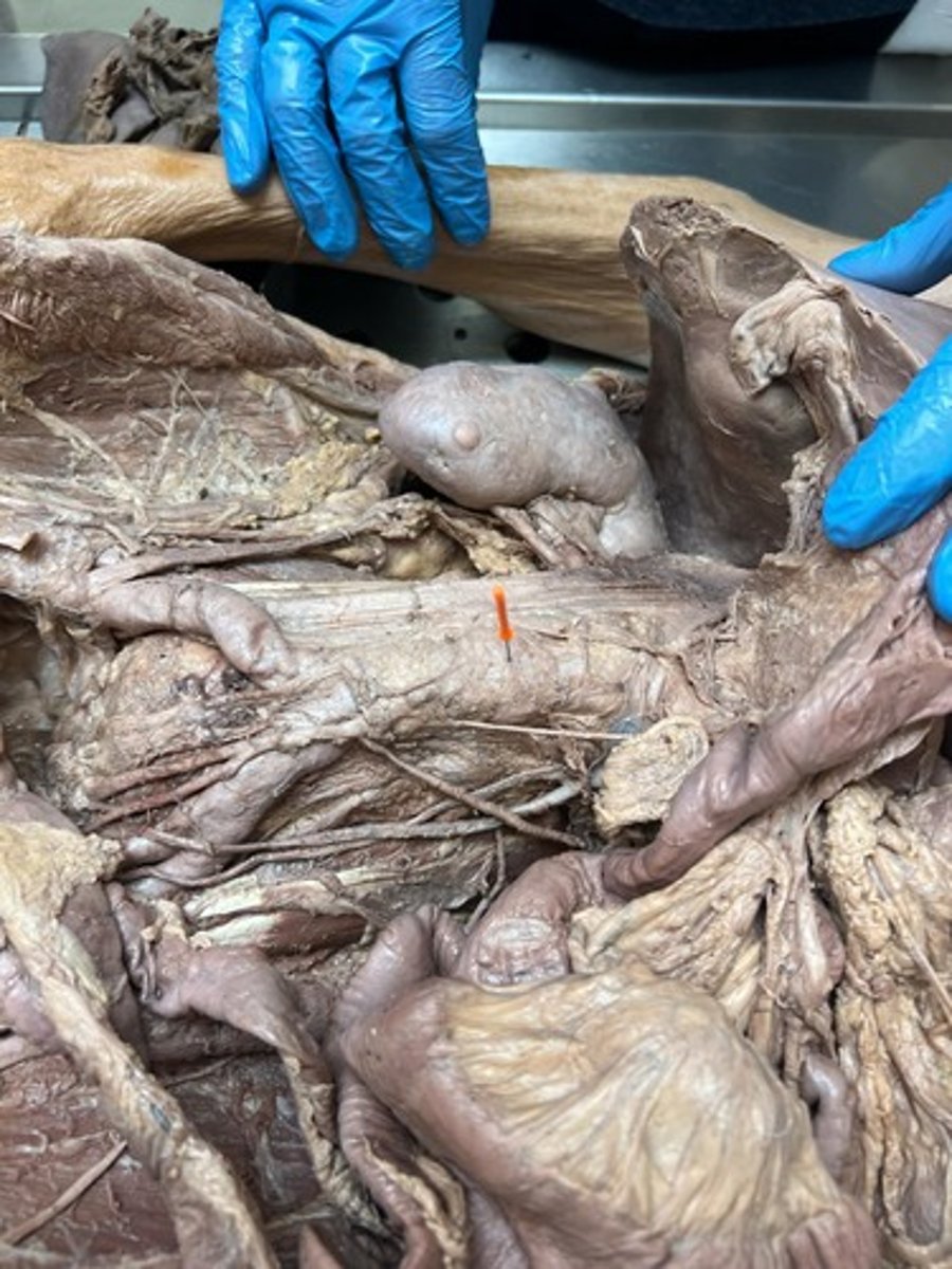 <p>abdominal aorta</p>