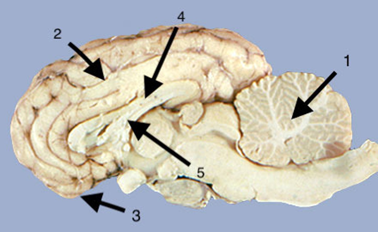 <p>What is 1?</p>