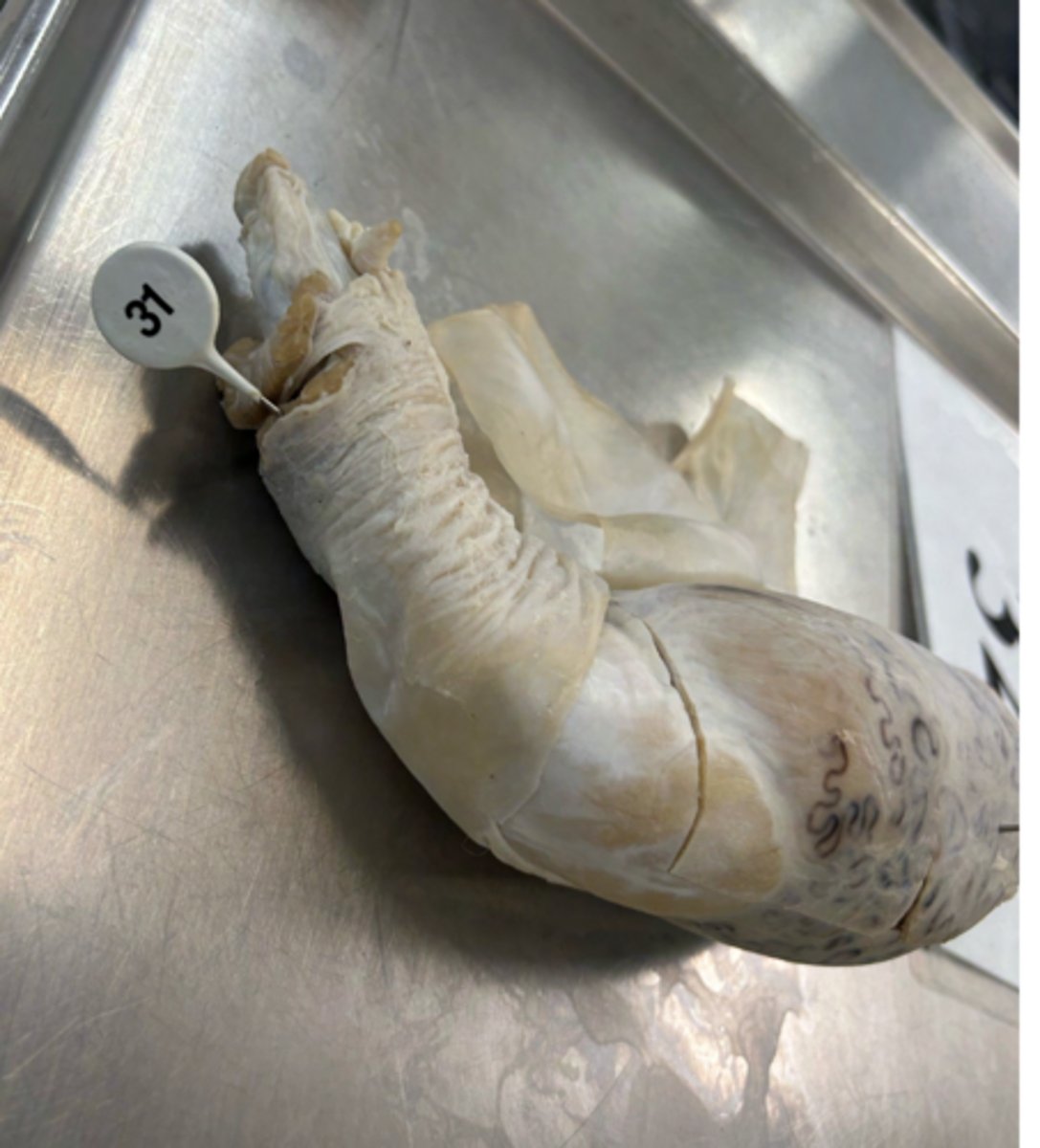 <p>from which muscle is this tissue derived?</p>