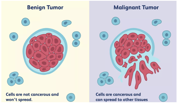 <ul><li><p>Mutations cause cells to stop expressing the correct proteins, losing function and specialization</p></li><li><p>Tumor: Mass of cells</p></li></ul>