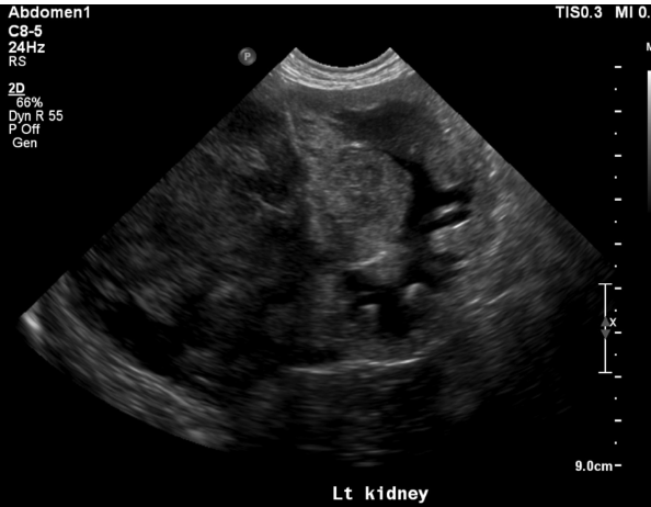 <p>what is going on with this kidney</p>