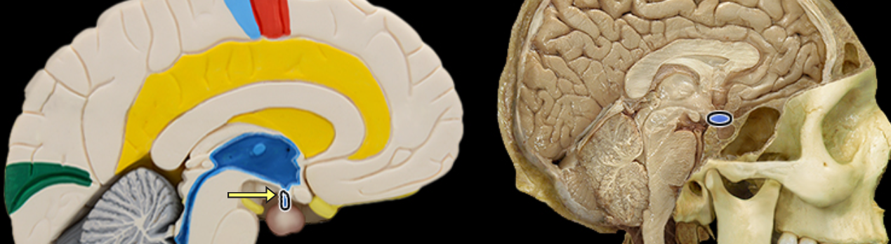 <p>Infundibulum of pituitary gland</p>