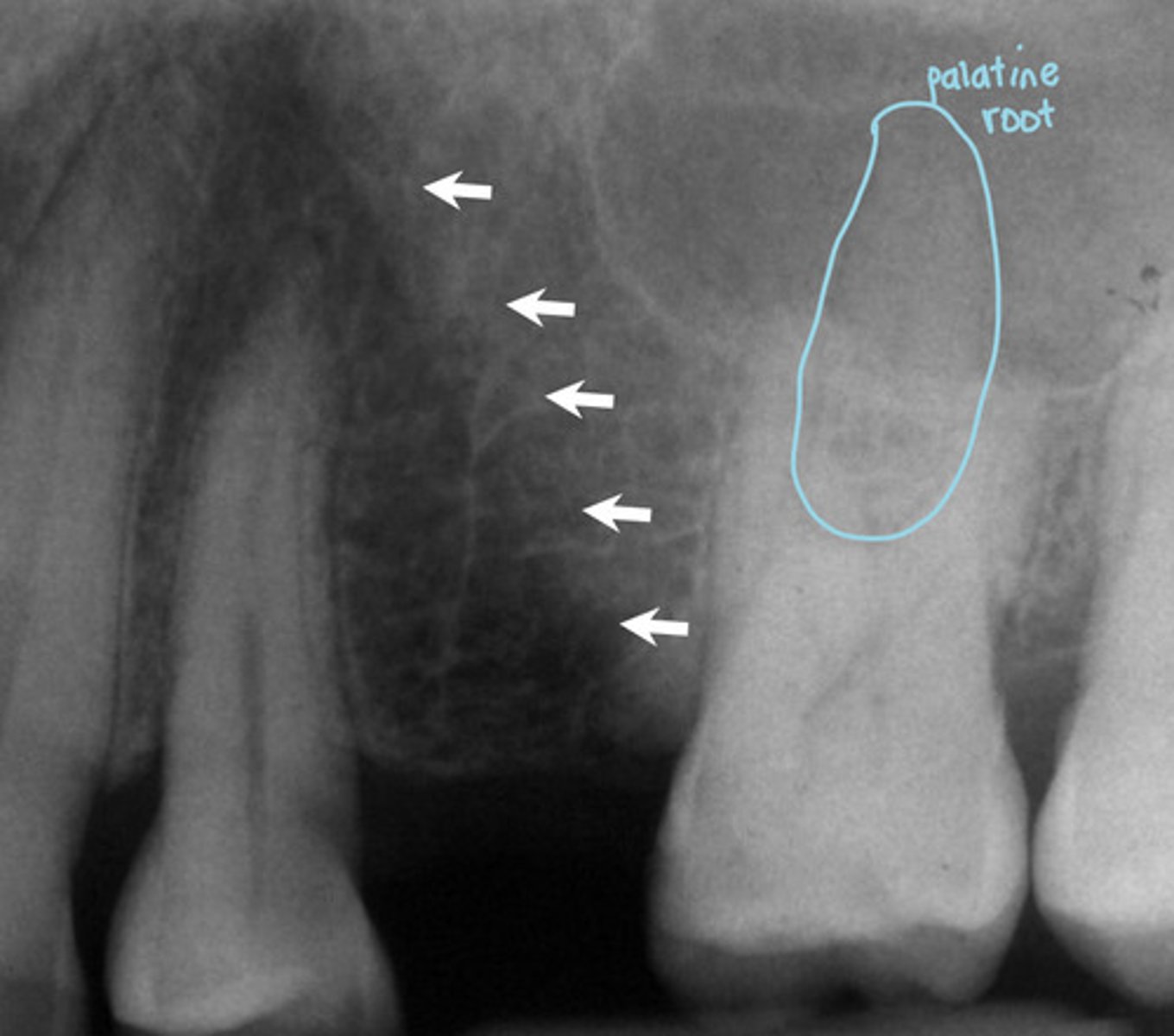 <p>What are the white arrows pointing to?</p>