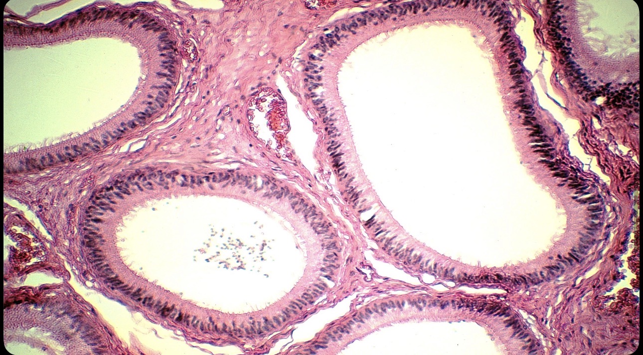 <p>Células epiteliales cilíndricas con microvellosidades largas</p>