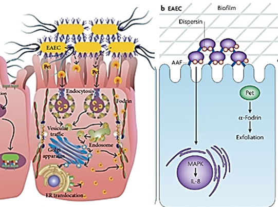 <ol><li><p>EAEC <strong>adheres to intestinal cells</strong> using <strong>aggregative adherence fimbriae</strong>, forming a <strong>"stacked brick" lesion</strong>.</p></li><li><p>EAEC produces <strong>biofilms</strong>, helping it <strong>evade the immune system</strong> and <strong>block nutrient and water absorption</strong>.</p></li><li><p>EAEC <strong>produces toxins</strong>, although their exact mechanism is not fully understood.</p></li><li><p>EAEC flagellin binds to <strong>TLR5 receptors</strong>, stimulating <strong>IL-8</strong> and <strong>cytokine production</strong>, contributing to <strong>diarrhea</strong>.</p></li><li><p>Increased <strong>mucus production</strong>, <strong>biofilm accumulation</strong>, and <strong>bacterial aggregates</strong> lead to <strong>prolonged diarrhea</strong>, which can cause <strong>malnutrition and stunted growth</strong>, especially in children.</p></li></ol><p></p>