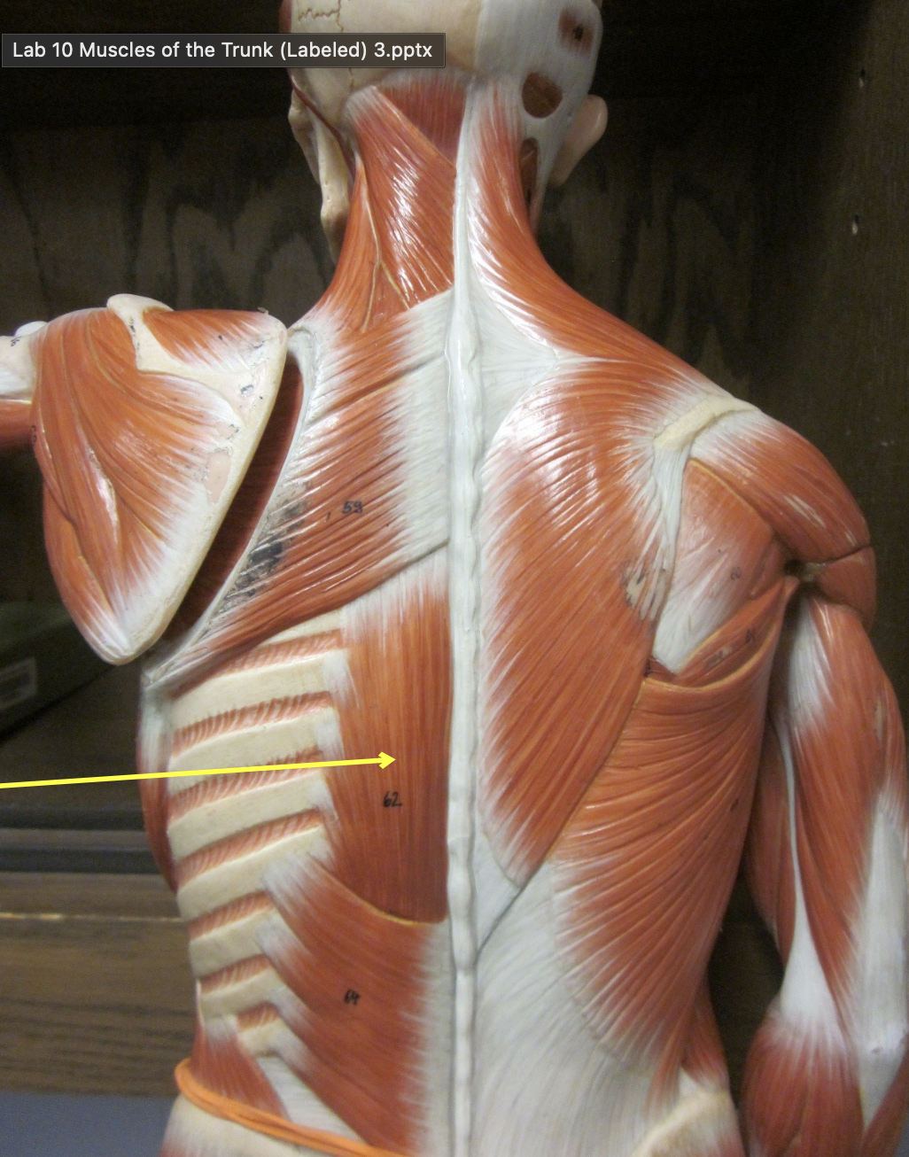 <p>Which muscle</p>