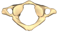<ul><li><p>C1</p></li><li><p>Articulates with occipital bone</p></li></ul><p></p>