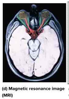 <ul><li><p>Best for soft tissue</p></li><li><p>Can see through the skull &amp; spine</p></li><li><p>Mechanics for MRI:</p></li></ul><p>Magnetic field aligns atoms</p><p>Radio waves REALIGN atoms</p><p>Radio turned off</p><p>Atoms realign to MAGNETIC FIELD</p><p>Energy given off depending on tissue type</p><p></p>