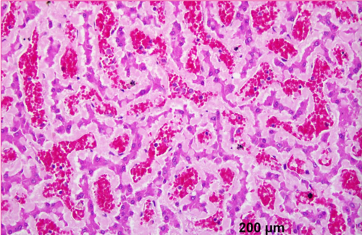 <p>describe the extracellular inclusion</p>