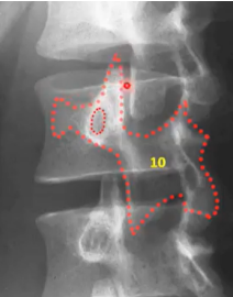 <p>findings + structures</p>
