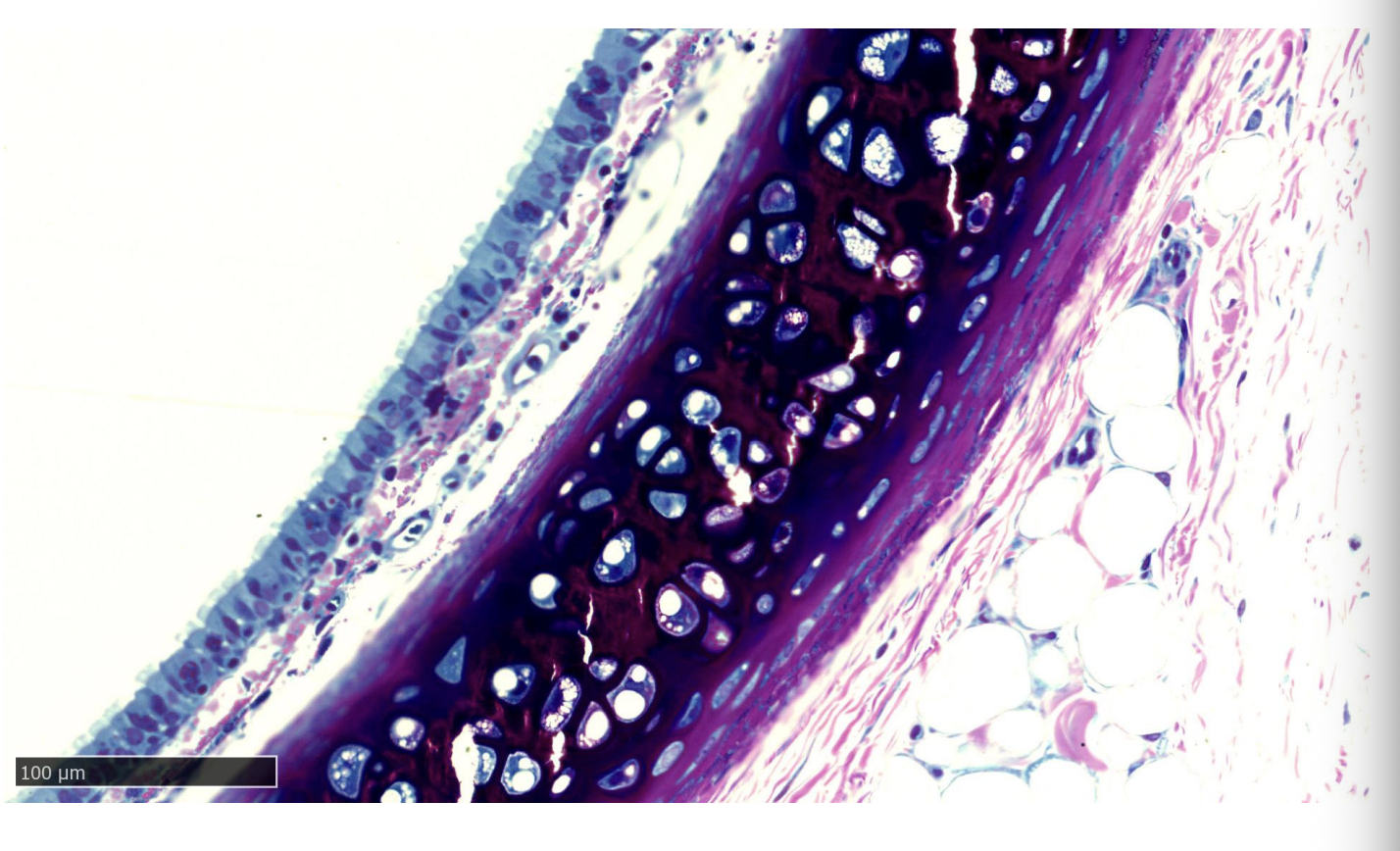 <ul><li><p>collagen?</p></li></ul><p></p>