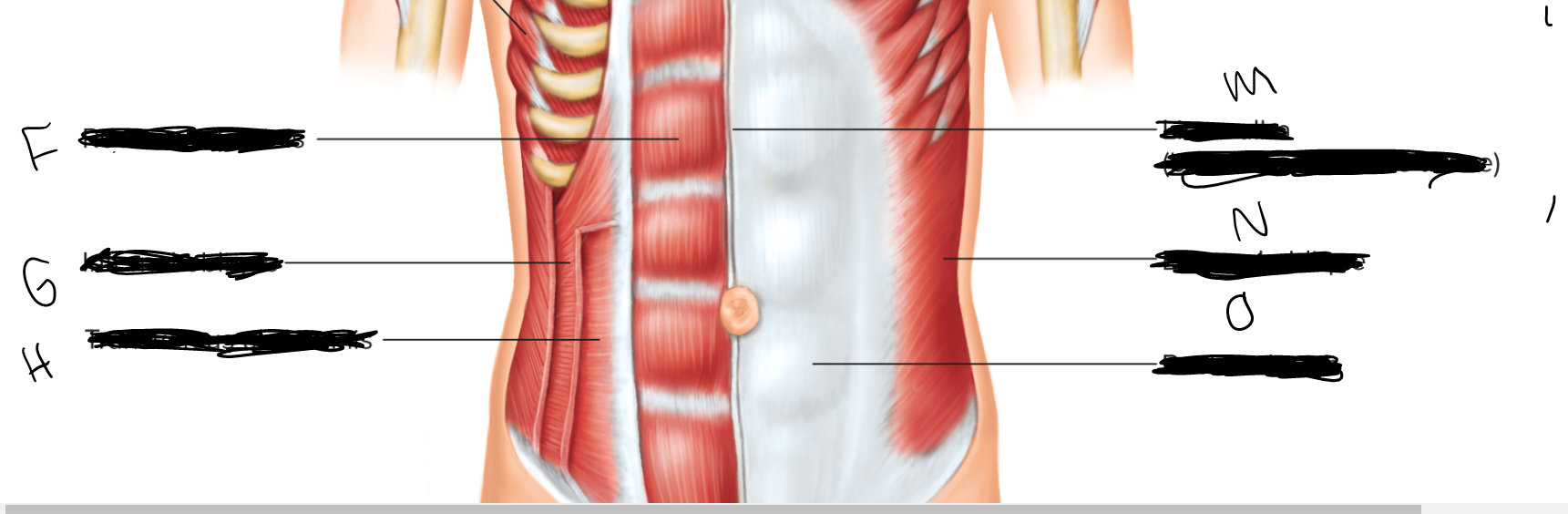 transversus abdominis