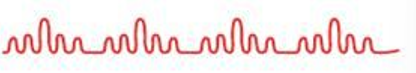 <p>(chest &amp; lungs)</p><ul><li><p>respiration patterns:</p><ul><li><p>description: <span>regular pattern characterized by alternating periods of deep, rapid breathing followed by periods of apnea</span></p></li><li><p>clinical indication: <span>may result from severe congestive heart failure, drug overdose, increased intracranial pressure, or renal failure; may be noted in elderly persons during sleep, not related to any disease process</span></p></li></ul></li></ul><p></p>