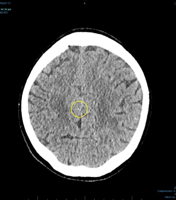 term image