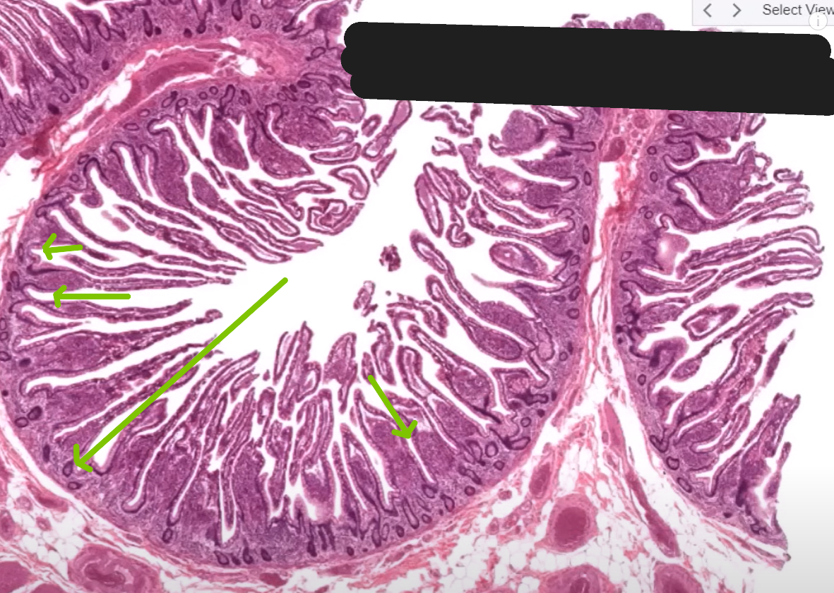 <p>Organ?</p><p>Structure represented by green arrow?</p><p>Cells at base of green arrow structure?</p><p>Structure between muscular layers?</p>