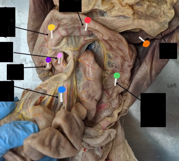 <p>What’s the orange pin </p>