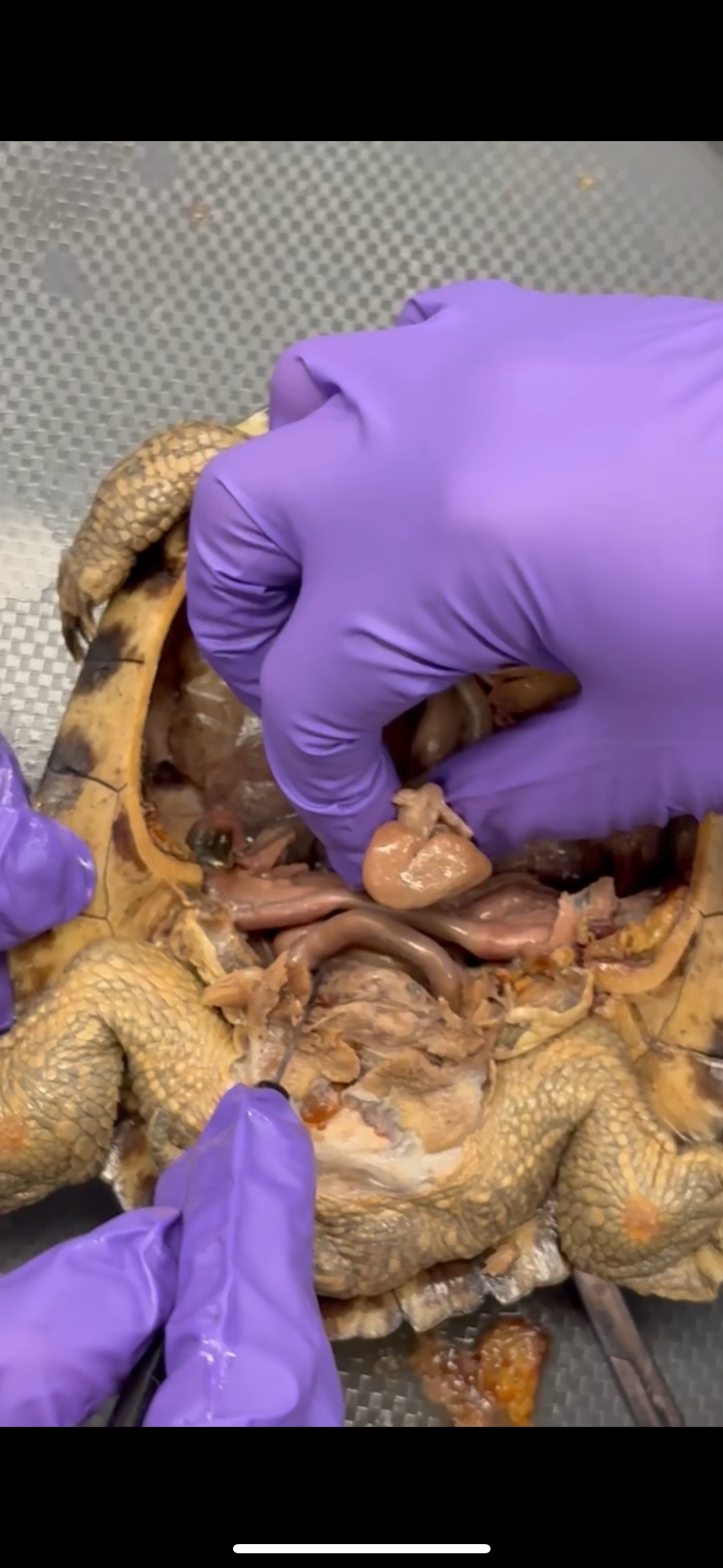 <p>What is being pinched</p>