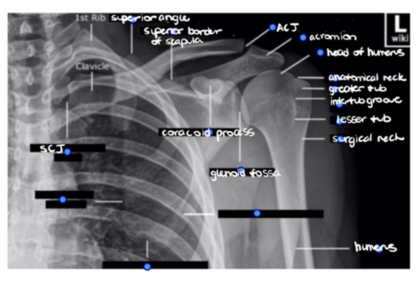 <p>ID the 3 missing structures.</p>