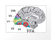 <ul><li><p><strong>strongly associated with face perception rather than general object recognition</strong>.</p></li><li><p>Found in the <strong>inferior temporal cortex</strong>, within the <strong>ventral visual stream ("what" pathway)</strong>.</p><ul><li><p>Typically more active in the <strong>right hemisphere</strong>, but present bilaterally.</p></li></ul></li></ul><ul><li><p>Damage to the FFA → Prosopagnosia ("Face Blindness")</p></li></ul><p></p>