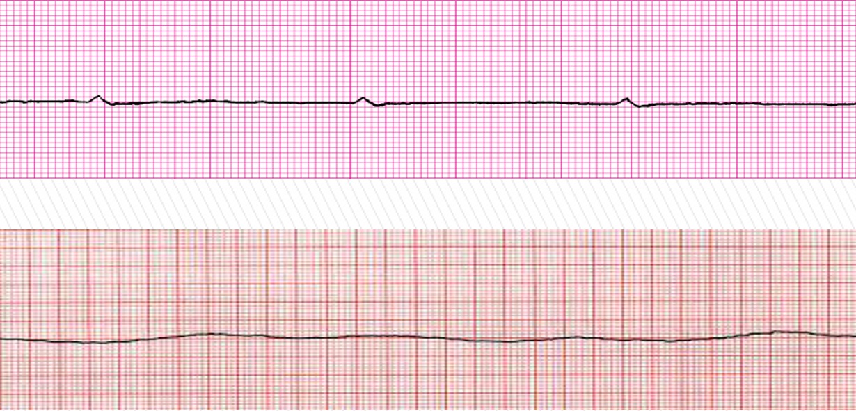 <p>What does the photo attached depict? </p>