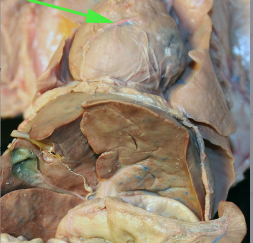 <p> <span>The vessel marked by the green arrow is a </span><strong>coronary artery</strong></p>