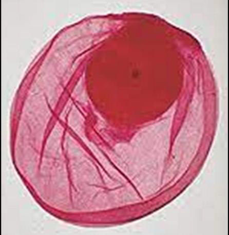 <p><strong>Identify this parasitic stage, its adult parasite, and mention the type of brain lesion it produces.</strong></p><p><strong>What is the definitive diagnostic technique?</strong></p><p><strong>Mention two morphological characteristics of this stage.</strong></p>