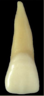 <p>maxillary central incisors #8 and #9; crown to root ratio</p>