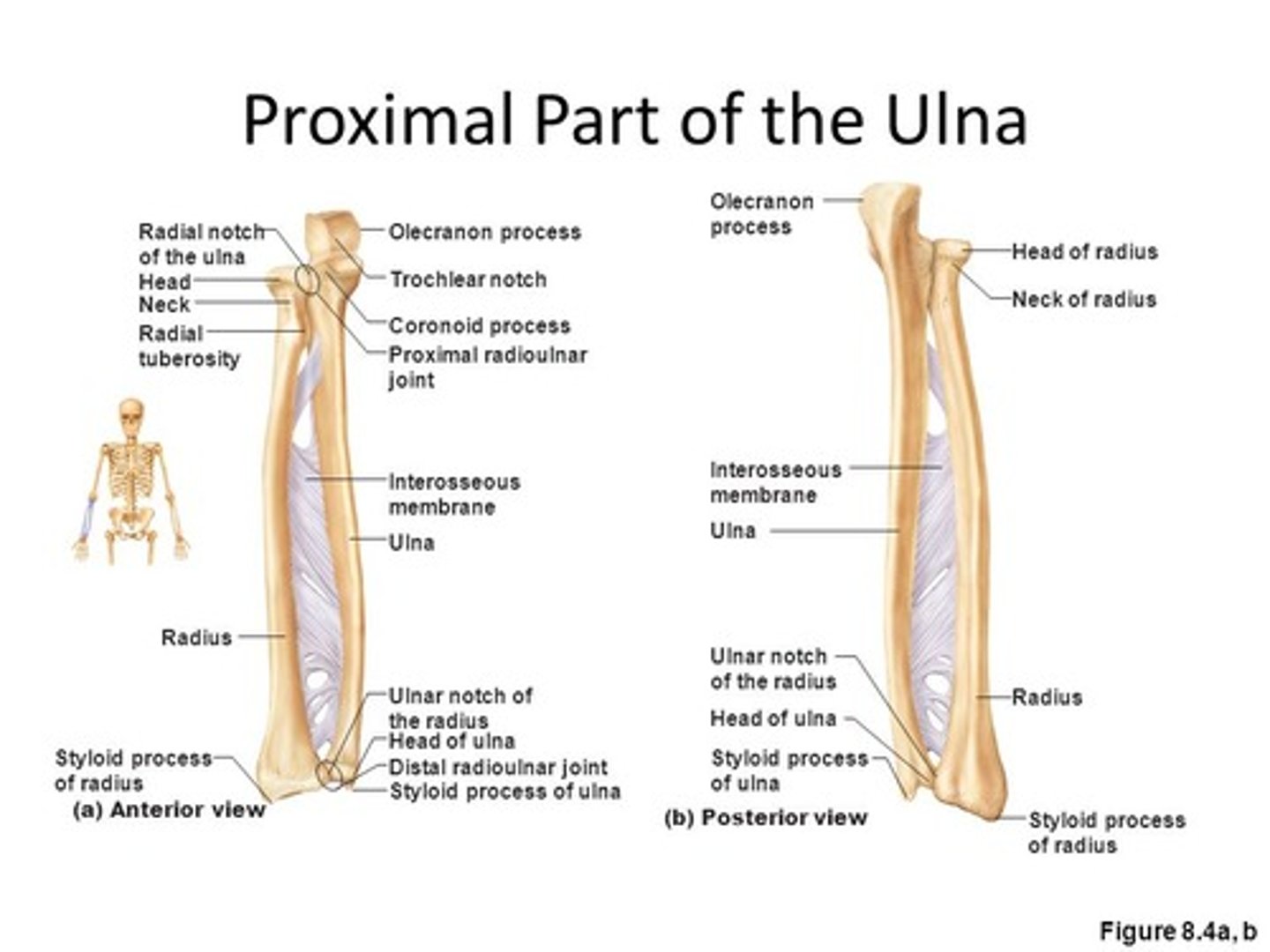 <p>Moving component: radius, convex moving on concave, osteo/arthrokinematic motion occurs in opposite directions</p>