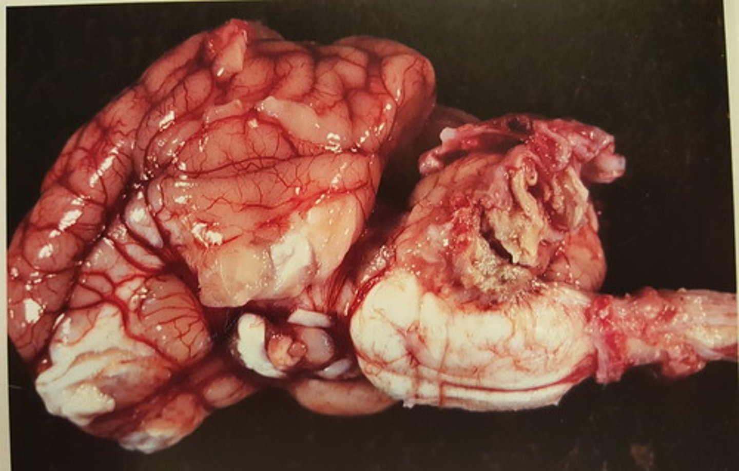 <p>Hjerne fra svin. Patoanatomisk diagnose? patogenesen?</p>