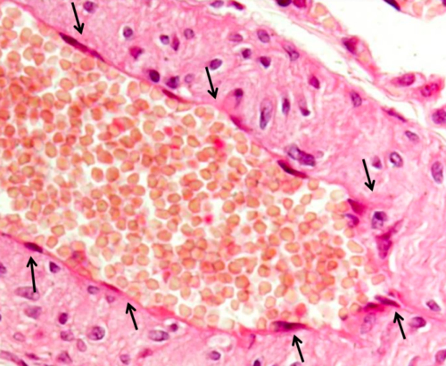 <p>endothelium (a type of simple squamous epithelium) covers...</p>