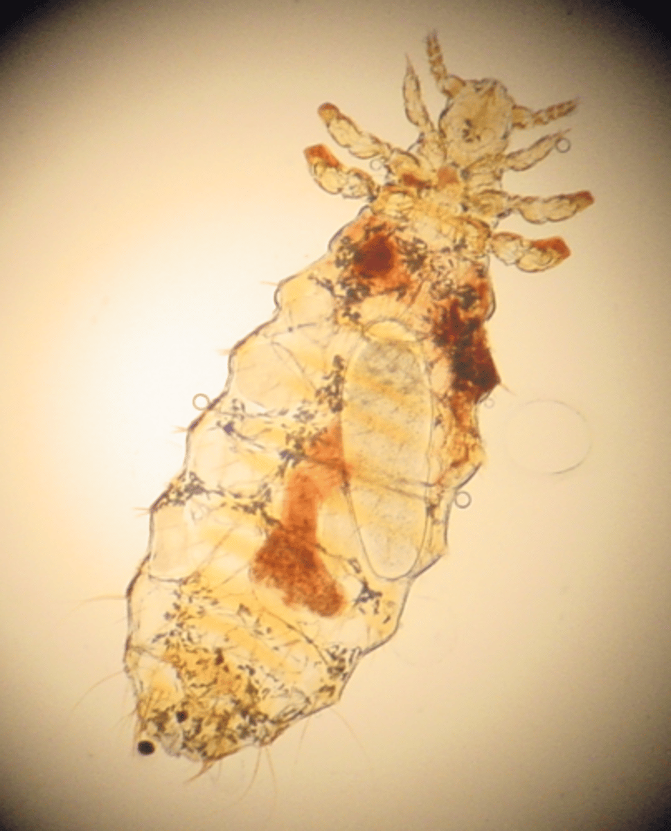 <p>what ectoparasite is seen in this image?</p>