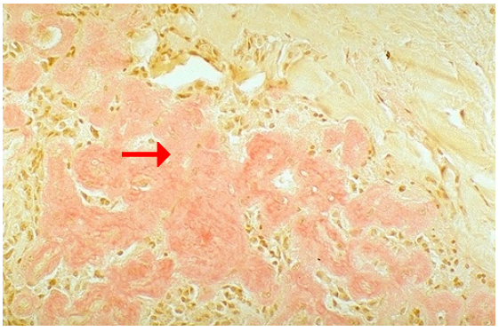 term image
