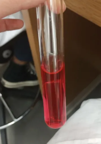 <ul><li><p><strong>*SB = Slow Basic</strong></p></li><li><p><strong>pH: Slow </strong>Basic</p></li><li><p><strong>Color: </strong>Patchy<strong> </strong>Red/Magenta Gradient</p></li></ul><p></p><p><strong>Explanation: </strong>This bacterium ferments carbohydrates and slowly releases organic acids.</p><p></p>