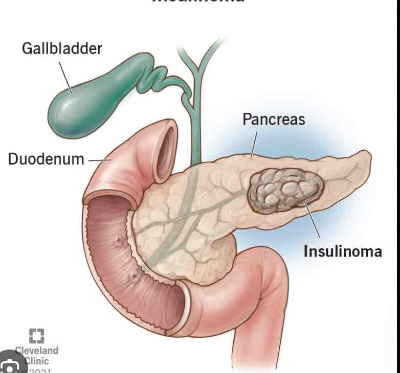 <p>Pancreas</p>