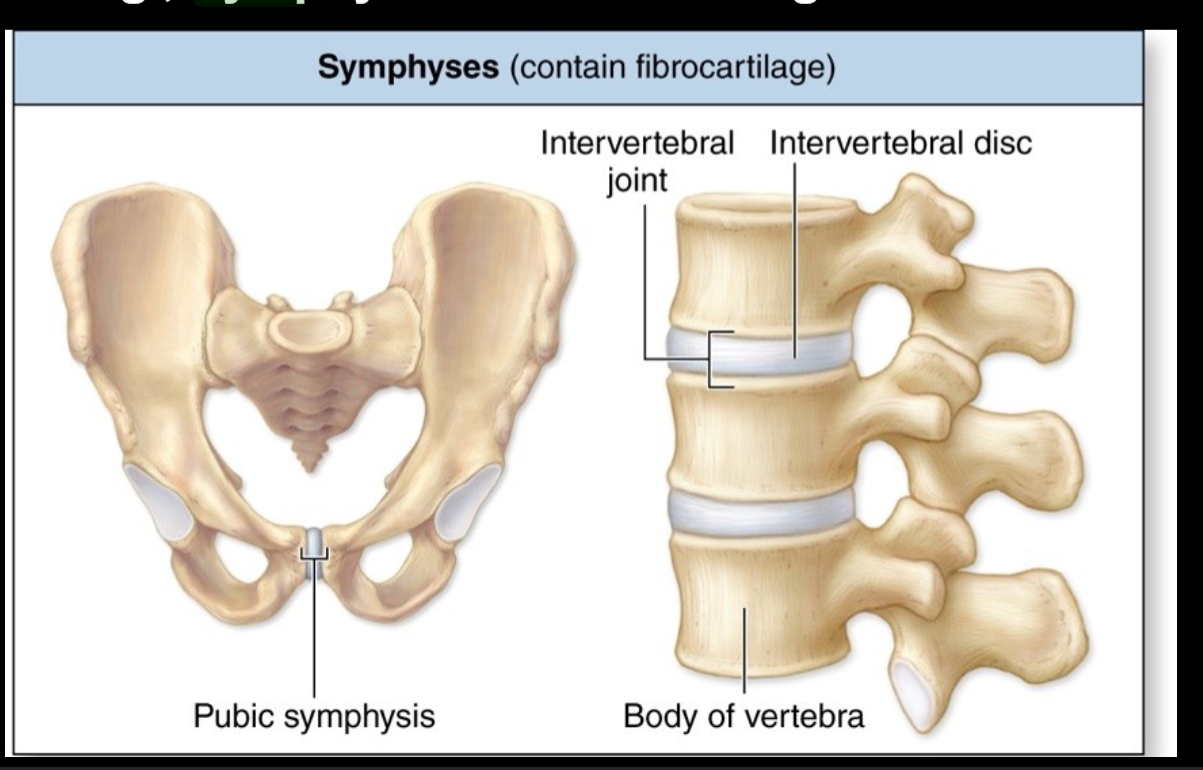 <p>symphyses of fibrocartilage</p>