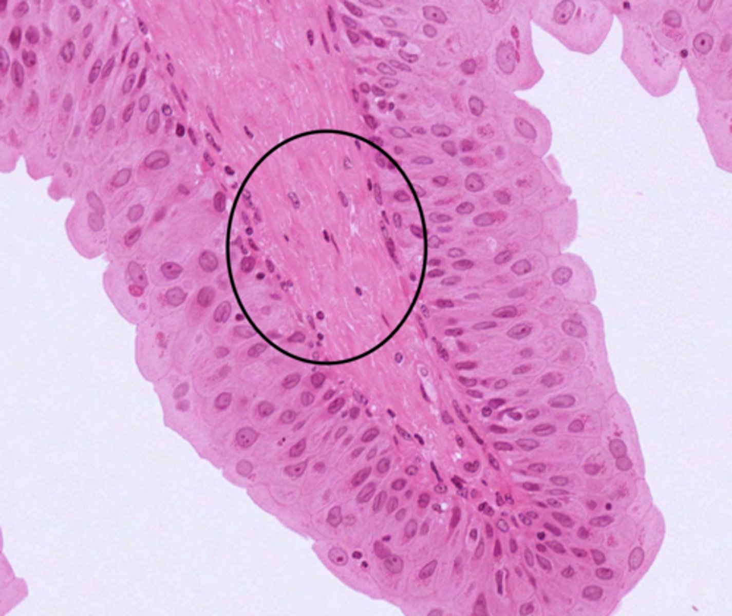 <p>Identify the layer of the ureter</p>
