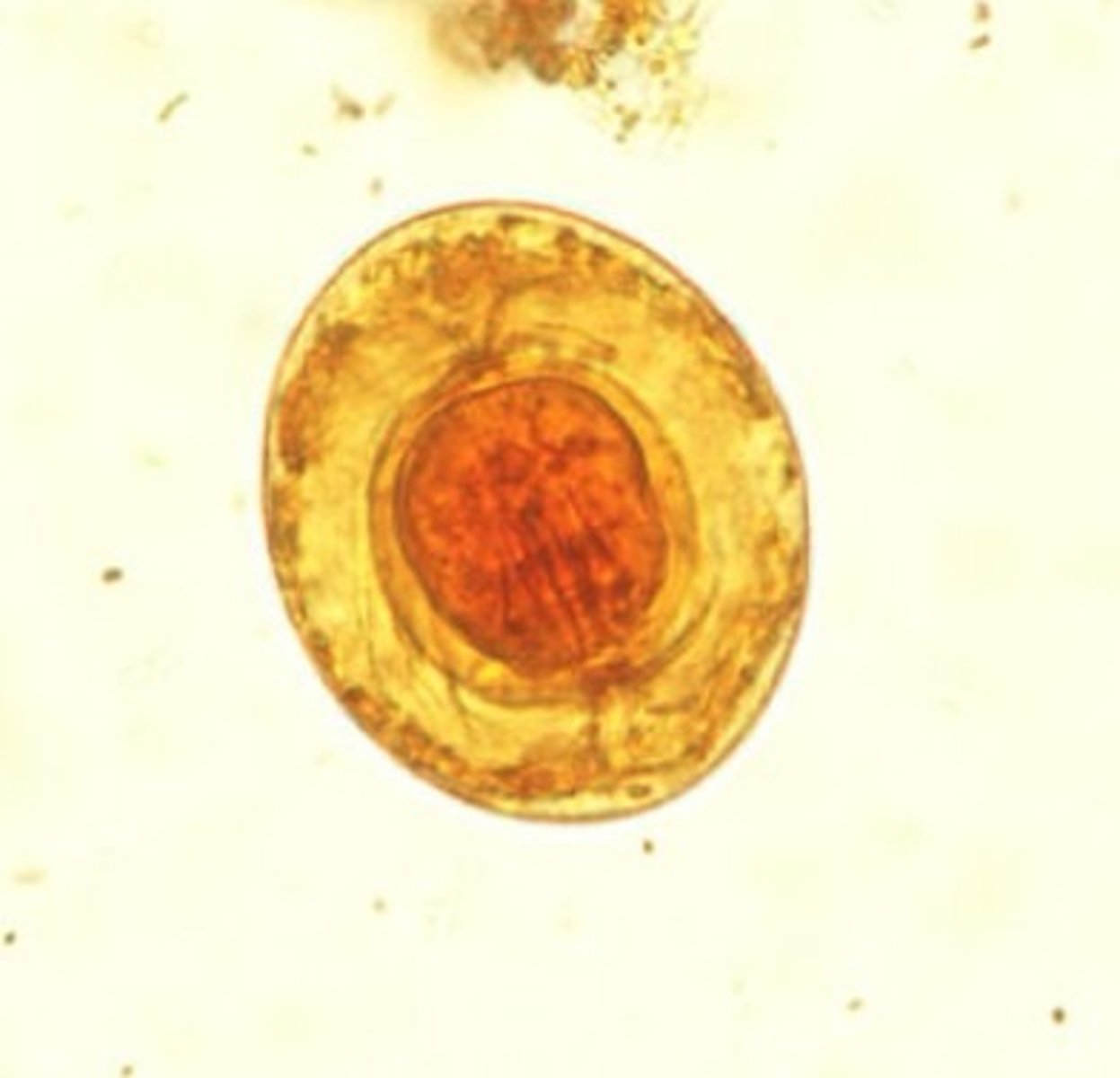 <p>Identify the parasite</p>