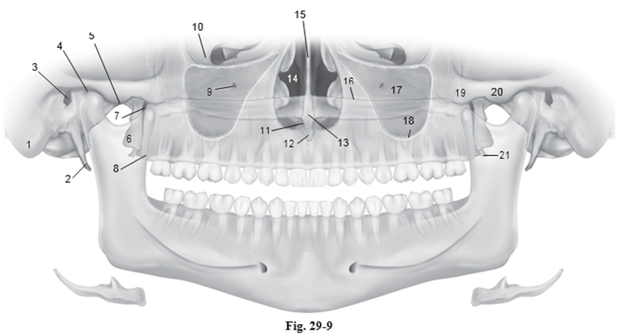 <p>Which number is the <strong>Maxillary tuberosity?</strong></p>